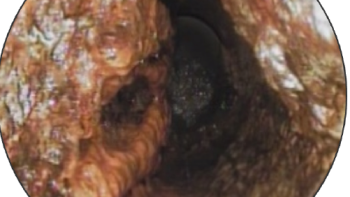 Sewer Robotics grease